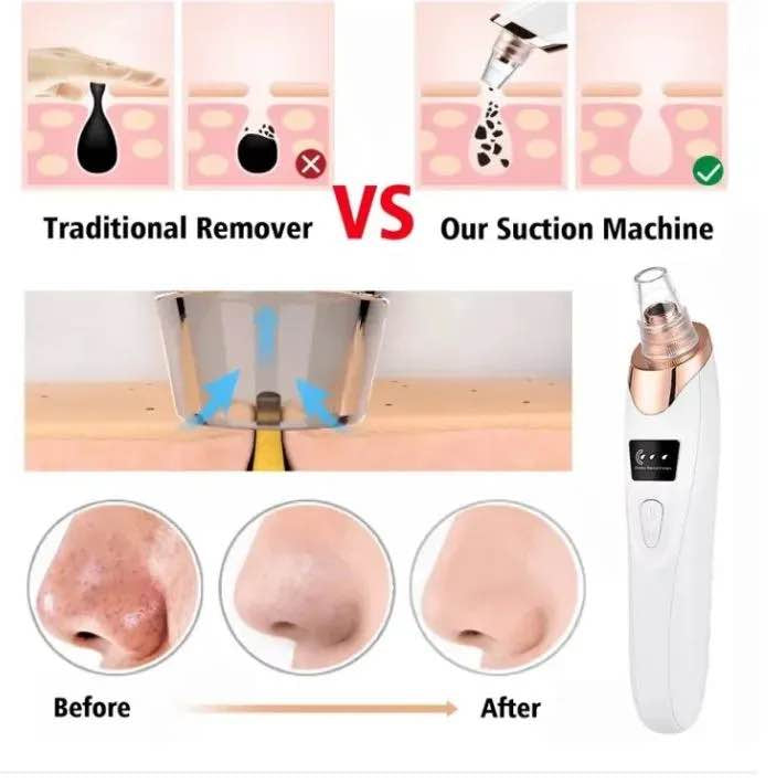 5 in 1 Electric Blackhead Acne Oil Remover Vacuum Suction Face Pore Cleaner Machine