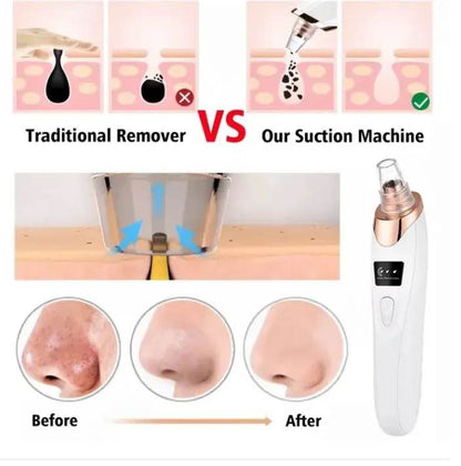 5 in 1 Electric Blackhead Acne Oil Remover Vacuum Suction Face Pore Cleaner Machine