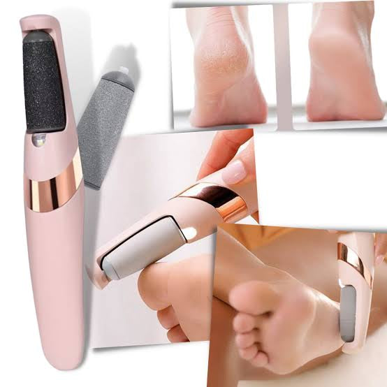 Electric Foot File Callus Remover