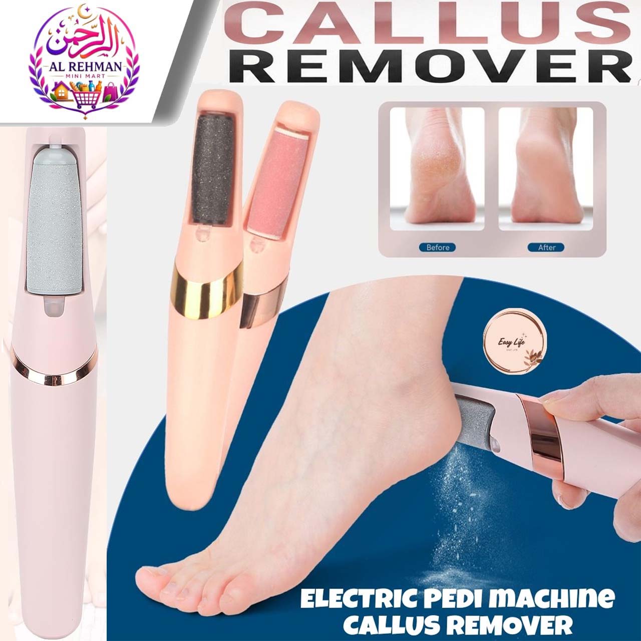 Electric Foot File Callus Remover